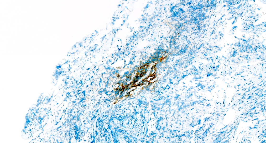 CD23