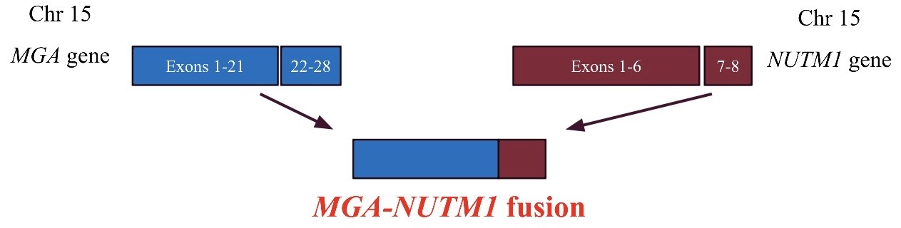 MGA::NUTM1 融合