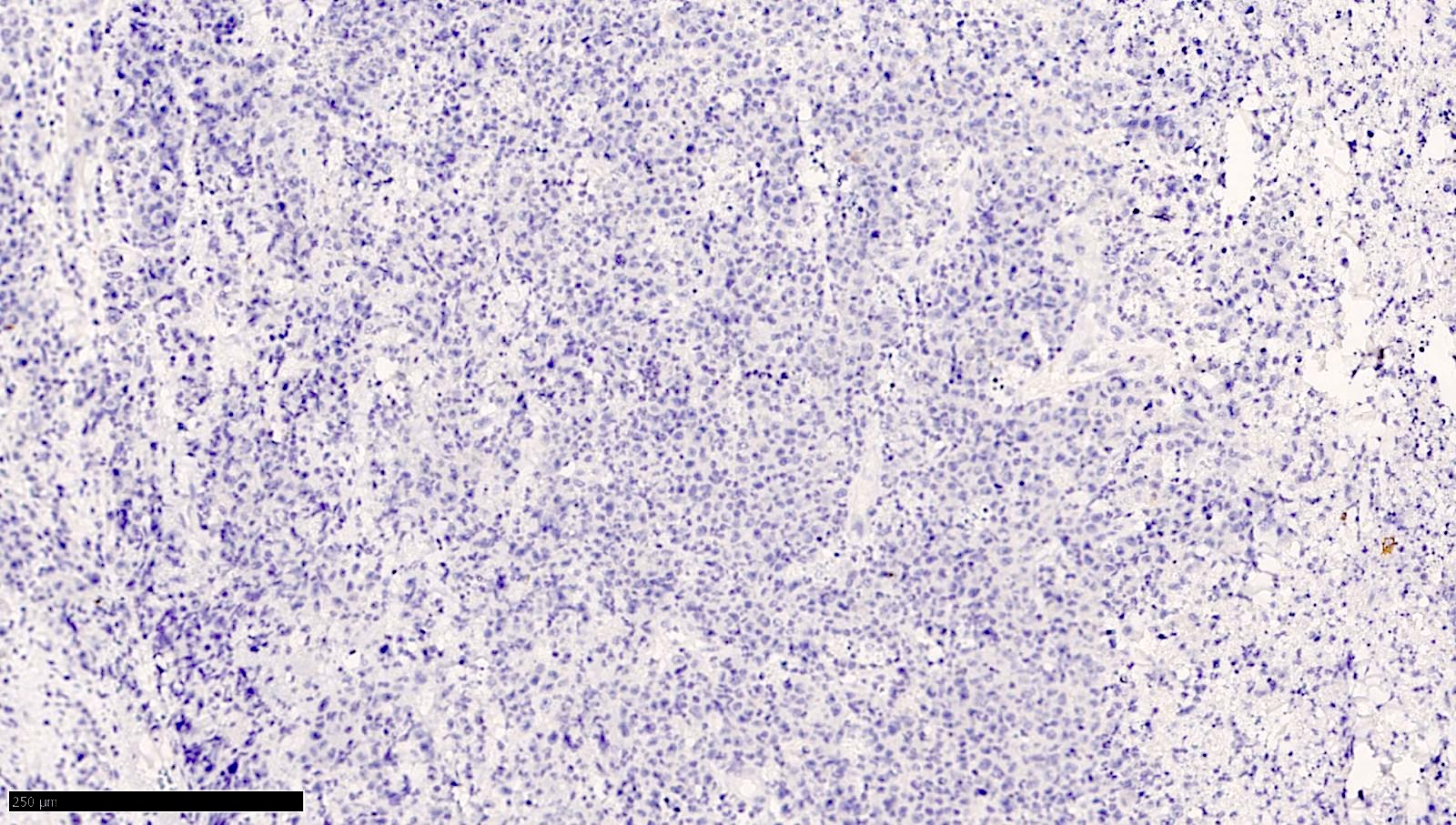 广谱细胞角蛋白（Pancytokeratin）