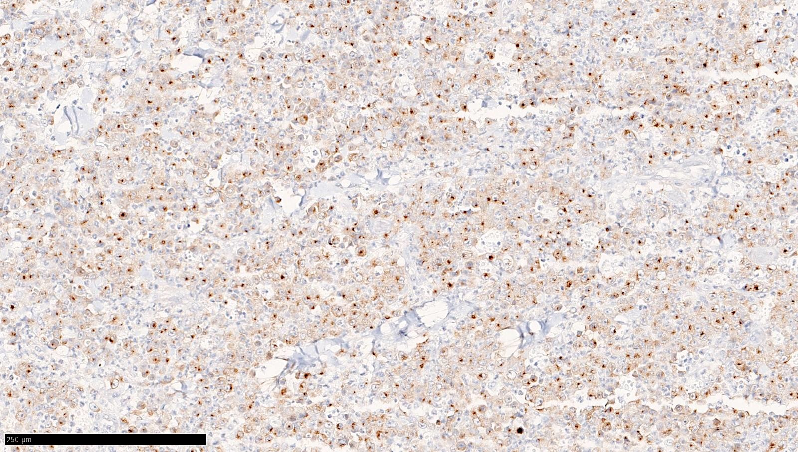 突触素（Synaptophysin）