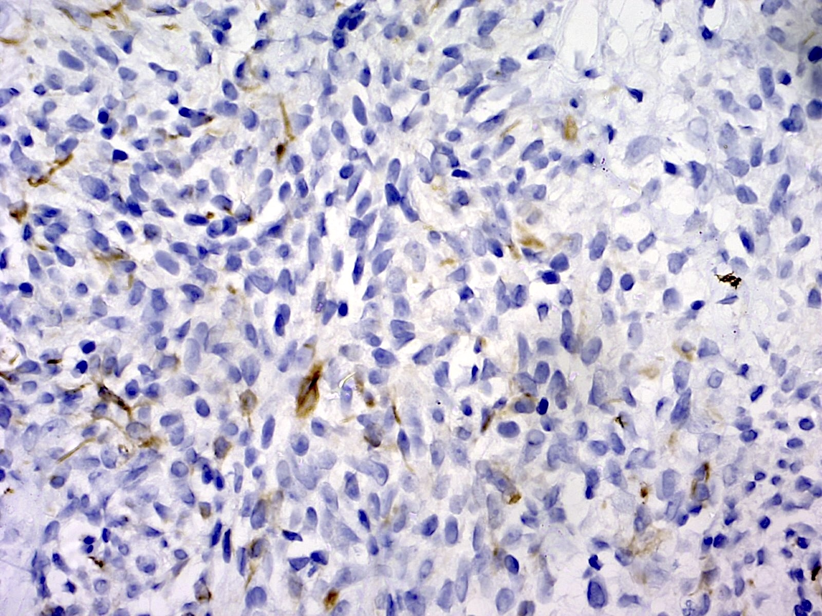 广谱细胞角蛋白（Pancytokeratin）