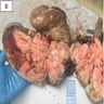 肠系膜肉瘤